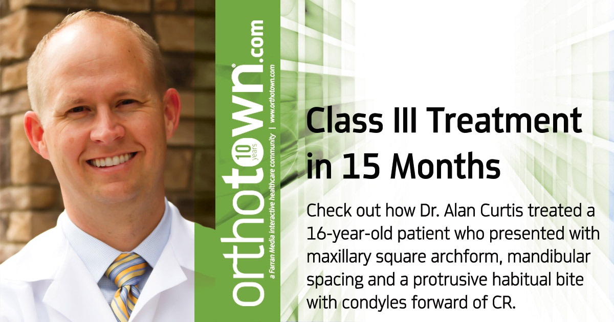 Class III Treatment in 15 Months Check out how Dr. Alan Curtis treated a 16-year-old patient who presented with maxillary square archform, mandibular spacing and a protrusive habitual bite with condyles forward of CR.