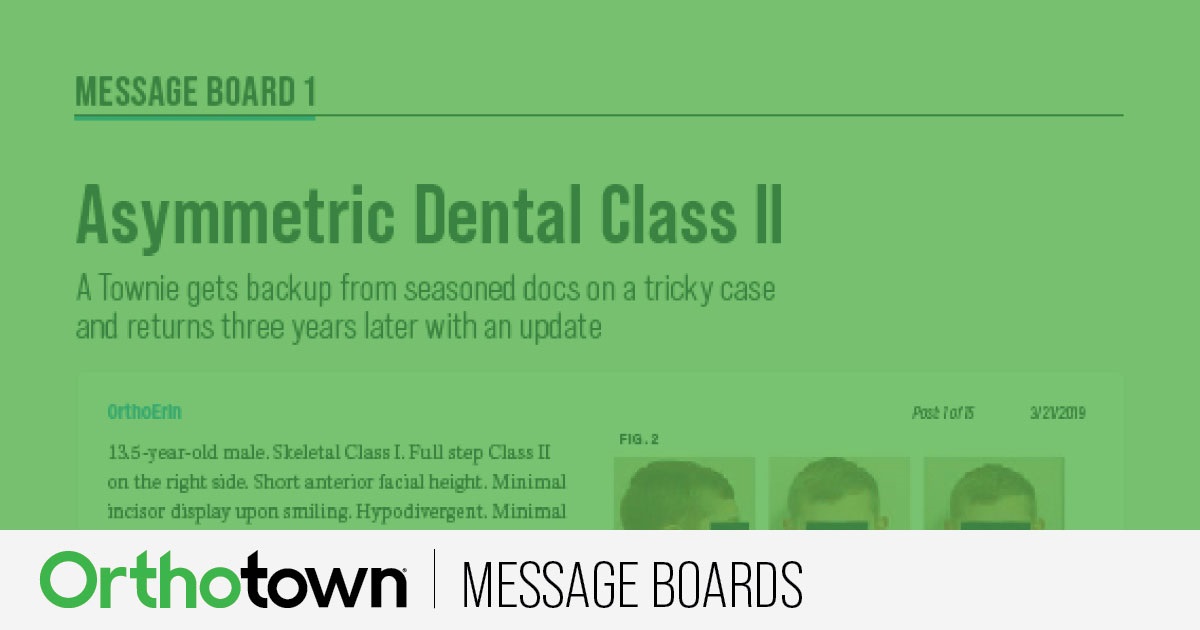 Asymmetric Dental Class II A Townie gets backup from seasoned docs on a tricky case.
