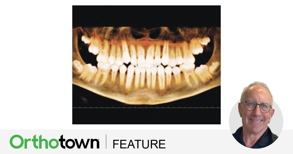 CE: Phase I Treatment Dr. Daniel J. Grob explains how, if patients are treated early, the interception of oral habits and medical conditions can make orthodontic correction easier and more successful later. Grob shares multiple cases that illustrate these principles at work. 