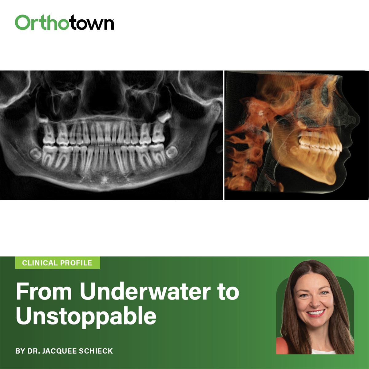 From Underwater to Unstoppable Dr. Jacquee Schieck discusses how she built her practice on her own terms using customization, remote monitoring, and intentionality.