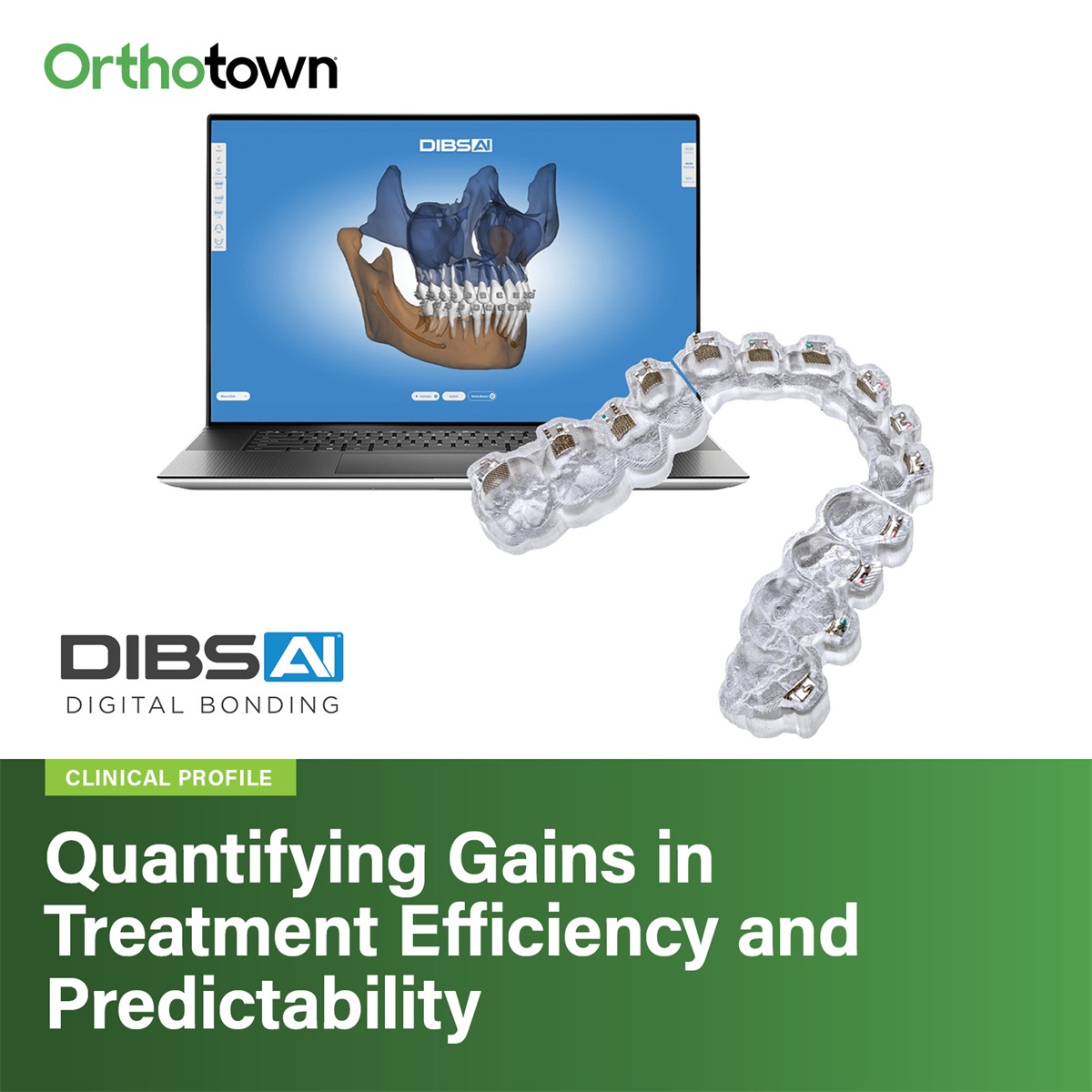 Quantifying Gains in Treatment Efficiency and Predictability A retrospective analysis examines how AI-assisted digital bonding compares to traditional direct bonding across treatment time, office visits, and mid-course adjustments.