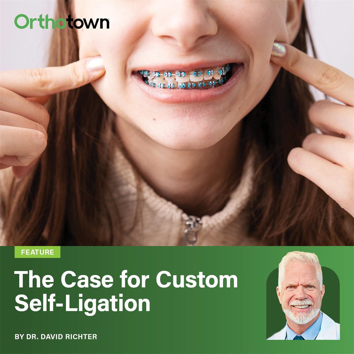 The Case for Custom Self-Ligation Dr. David Richter draws on five years of clinical experience to explain how digitally customized, self-ligating brackets can reduce treatment time by up to 40% and cut office visits by up to 50%.