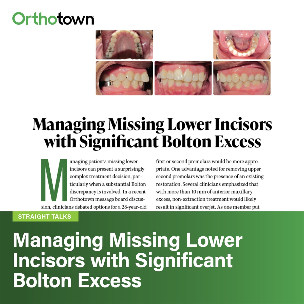 Managing Missing Lower Incisors with Significant Bolton Excess 