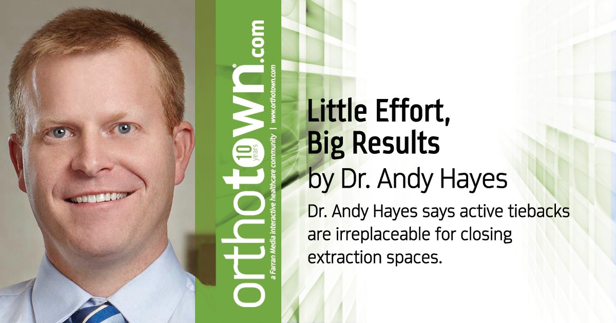 Little Effort, Big Results Dr. Andy Hayes says active tiebacks are irreplaceable for closing extraction spaces.