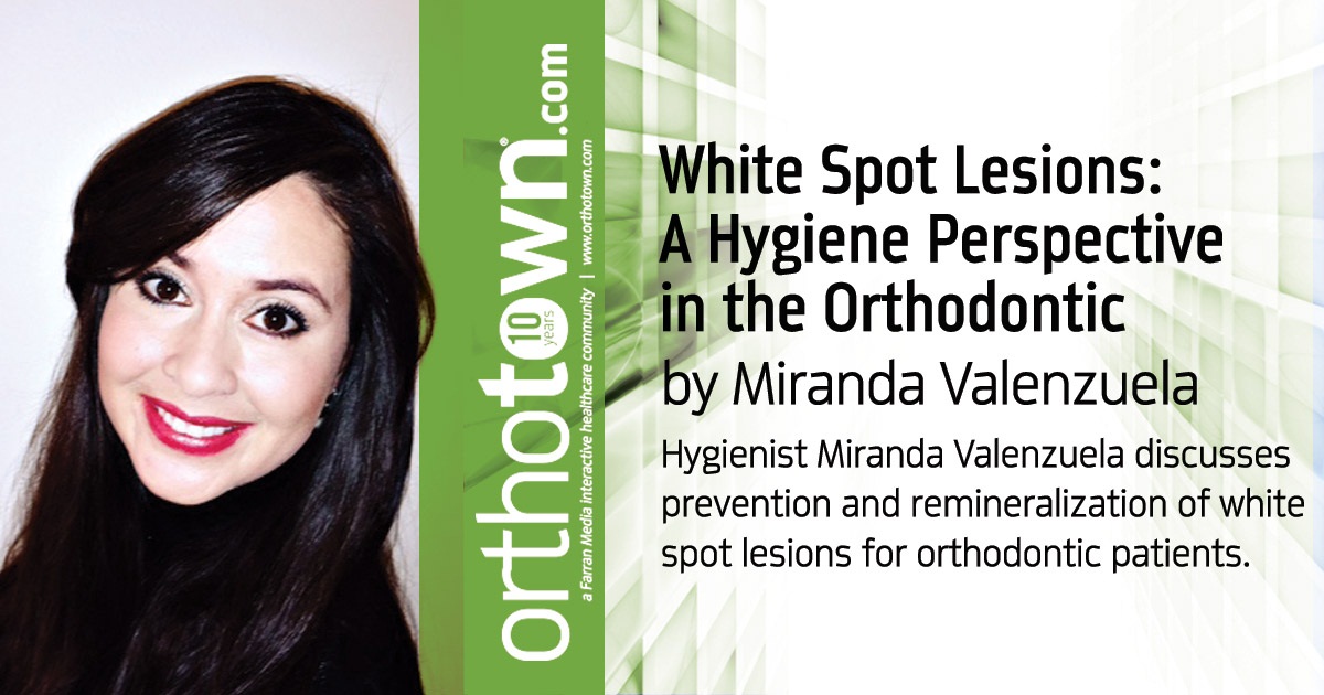 White Spot Lesions: A Hygiene Perspective in the Orthodontic Practice Hygienist Miranda Valenzuela discusses prevention and remineralization of white spot lesions for orthodontic patients.