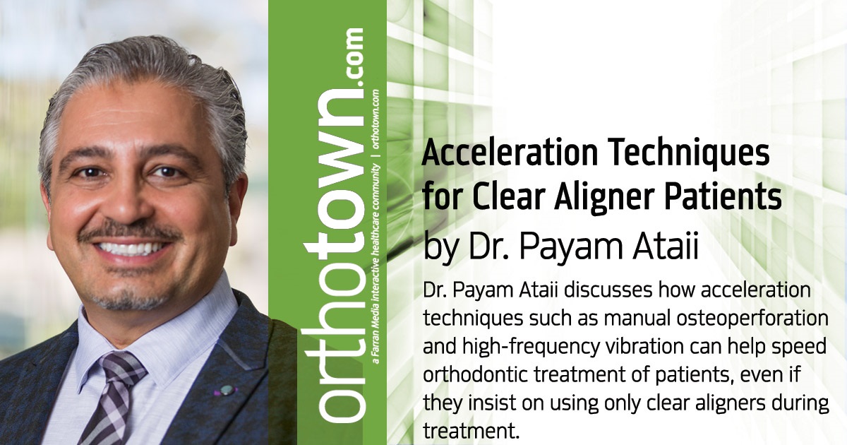 Acceleration Techniques  for Clear Aligner Patients Dr. Payam Ataii discusses how acceleration techniques such as manual osteoperforation and high-frequency vibration can help speed orthodontic treatment of patients, even if they insist on using only clear aligners during treatment.