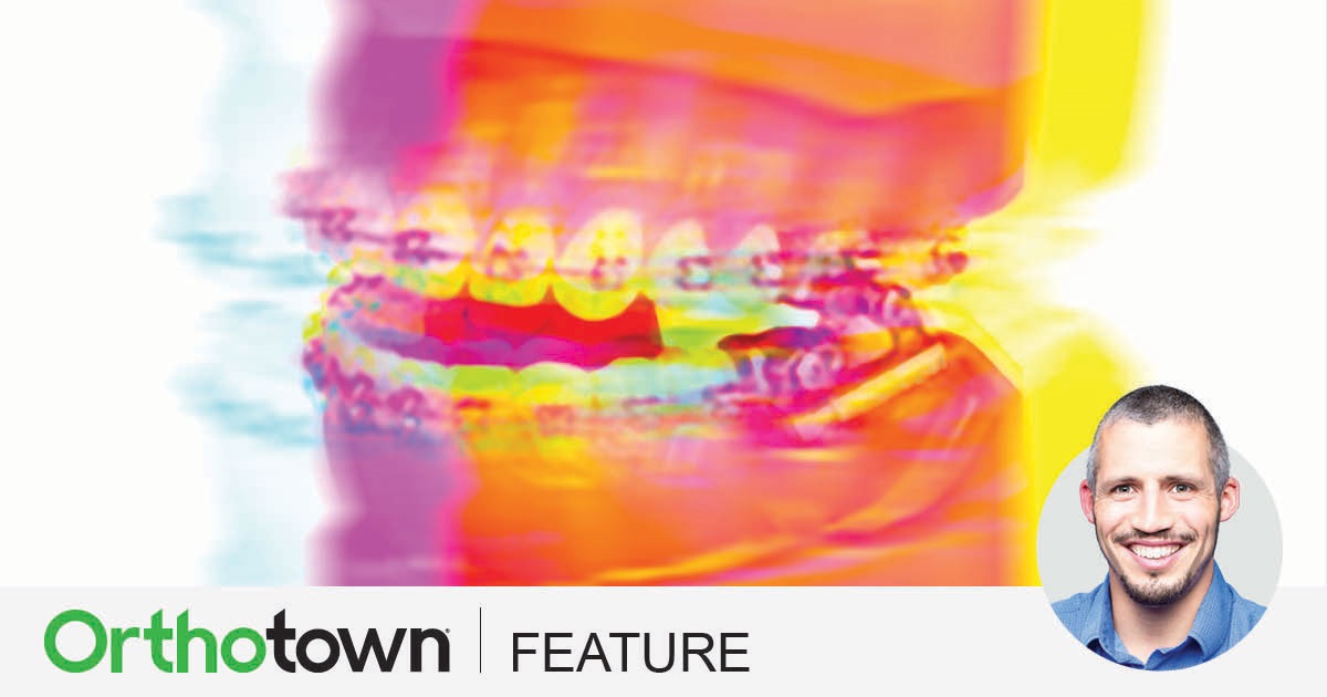 Efficient, Effective Herbst Treatment Dr. Mike DePascale discusses how he simplifies orthodontic treatment in his practice by using Herbst appliances.