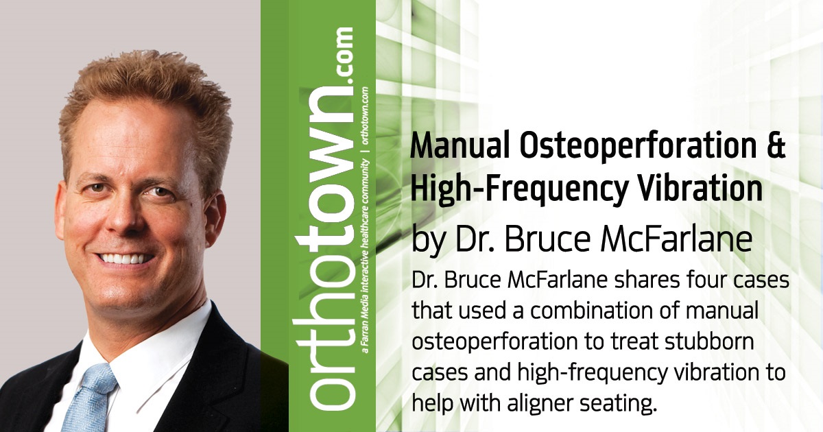 Manual Osteoperforation and High-Frequency Vibration Dr. Bruce McFarlane shares four cases that used a combination of manual osteoperforation to treat stubborn cases and high-frequency vibration to help with aligner seating.