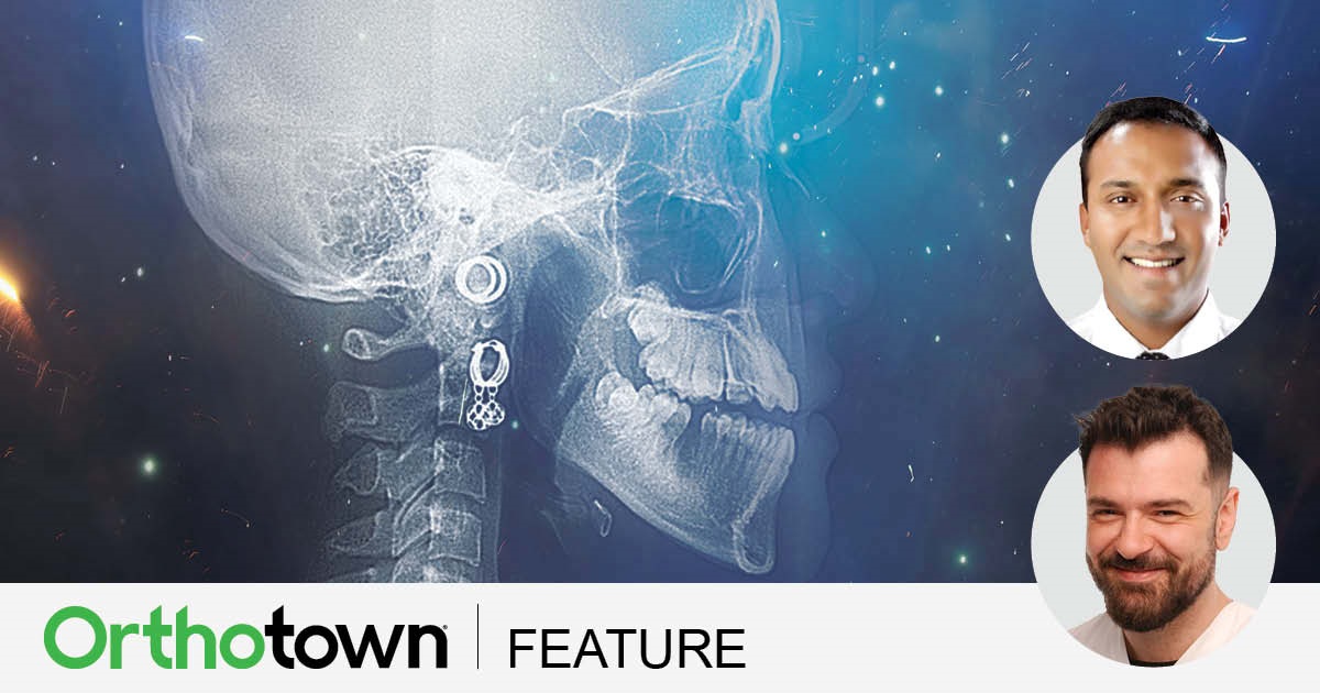 Iatrogenic Challenges Dr. Adith Venugopal and Dr. Can-Florian Keles discuss iatrogenic failures and clinical tips on how to correct them, sharing a couple of cases about their own experiences in this topic.