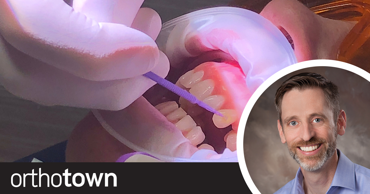 A Clear Method Dr. Darren Forcier explains how he treats “aesthetically astute” patients who aren’t keen on traditional braces. His preferred method uses clear aligners, digital workflows and composite attachments.