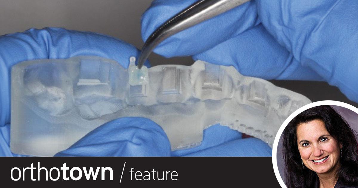 Better Bonding Dr. Lisa Alvetro discusses technological improvements that allow for indirect bonding procedures to be done in fewer steps with a shorter learning curve and simpler appointments, and also walks readers step by step through the protocol she uses in her practice.