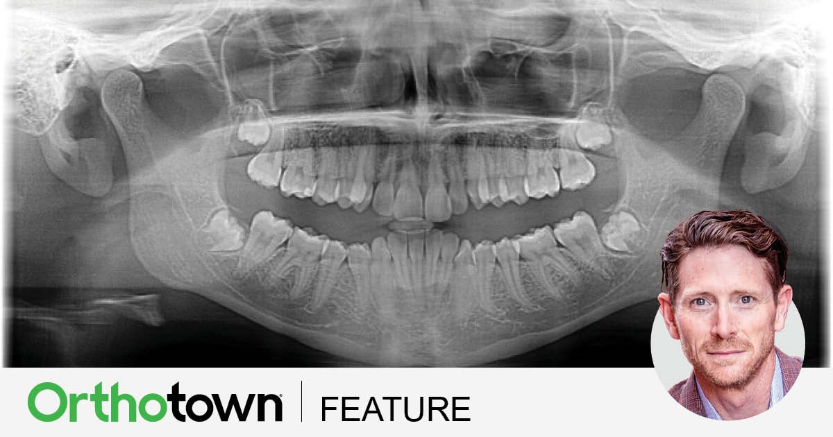 Earned Placement: It’s About Time 