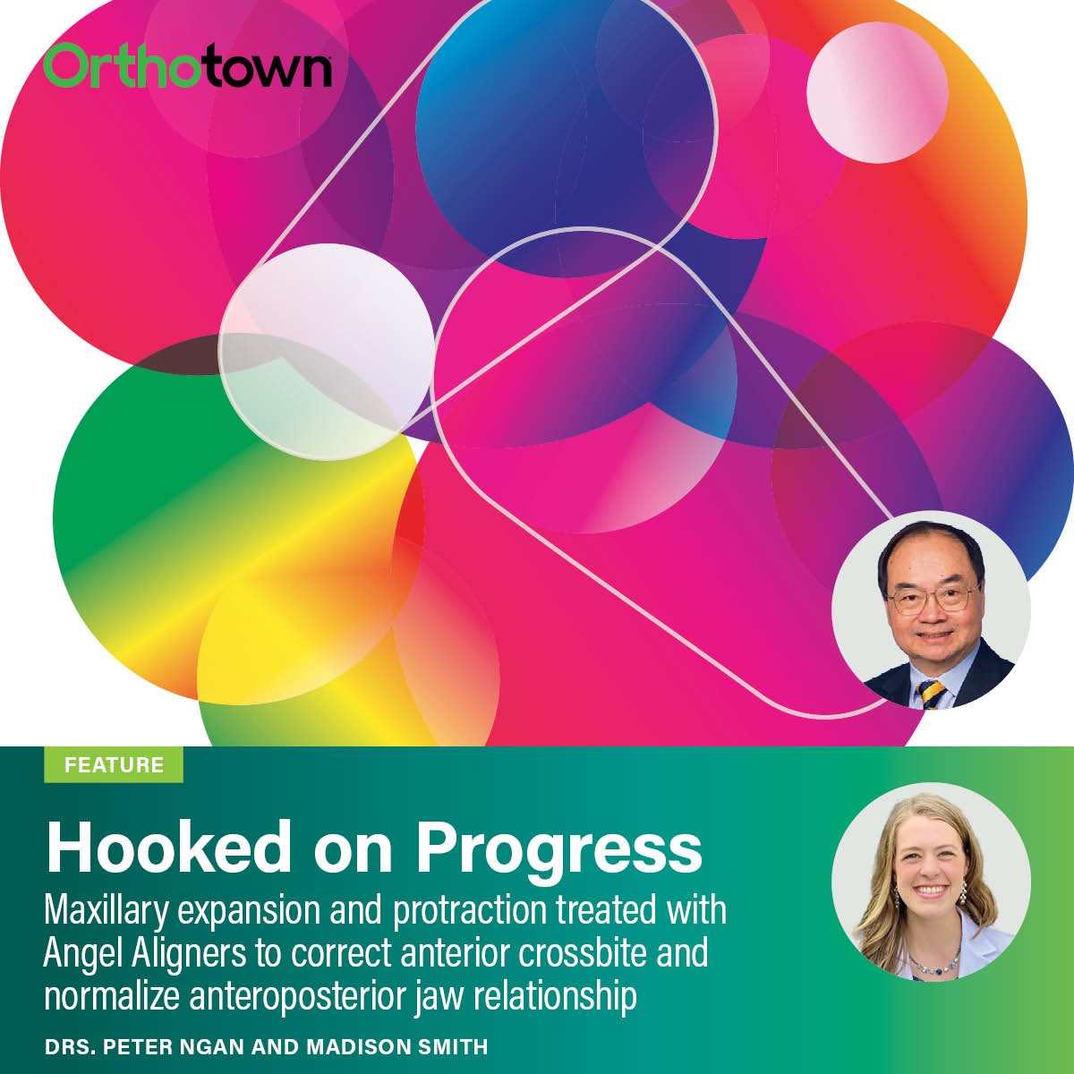 Hooked on Progress Drs. Peter Ngan and Madison Smith demonstrate how Angel Aligners can correct Class III malocclusion through expansion and protraction.