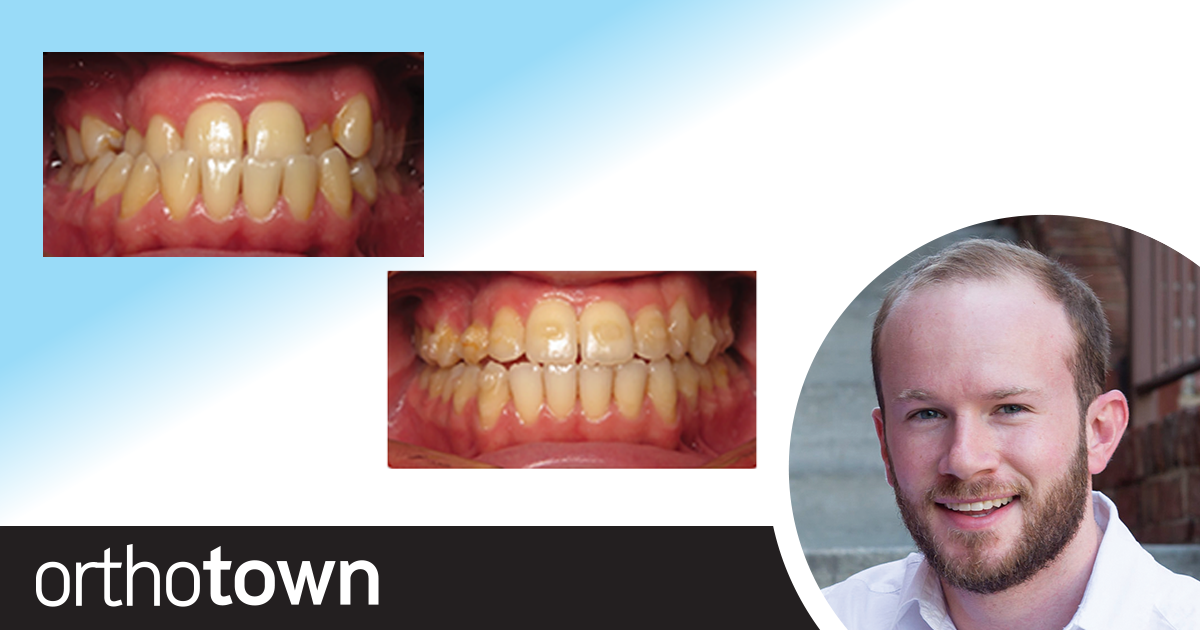 The Difference Is Clear Dr. Justin M. Hughes discusses aesthetic treatment options for adult patients