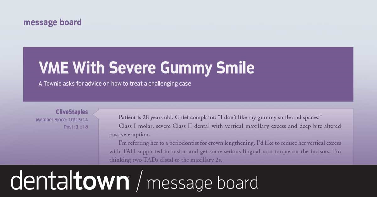 VME With Severe Gummy Smile A Townie asks for advice on how to treat a challenging case.