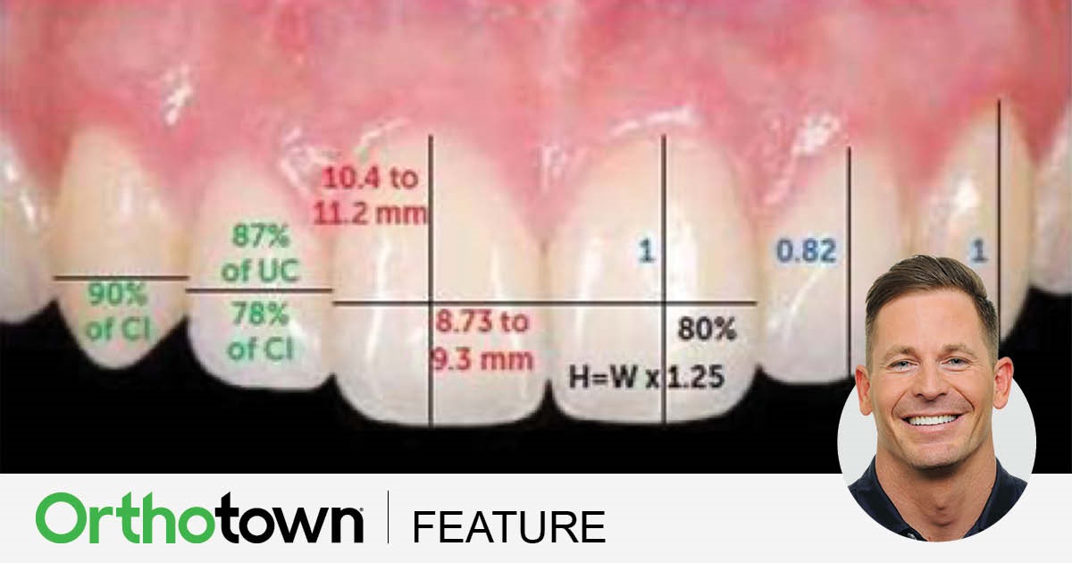 The Finishing Touches Dr. Trevor Nichols covers the art of hard- and soft-tissue sculpting after orthodontic treatment, which can take many ordinary cases to extraordinary through a simple method that requires little time.