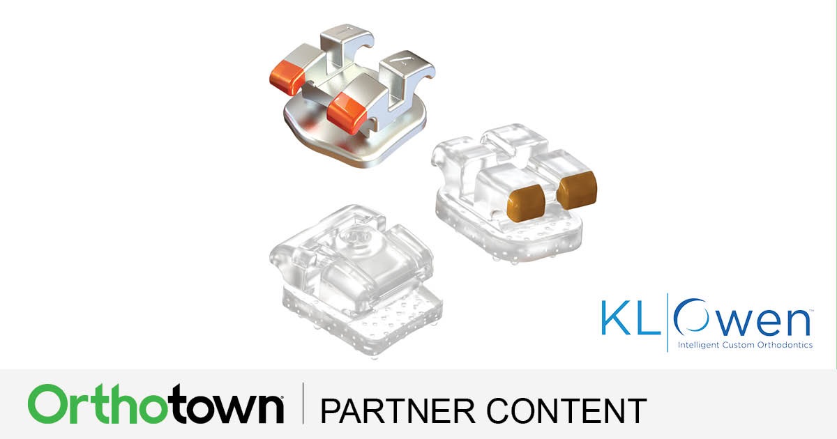 Product Profile: Stride Custom Braces Custom digital orthodontics meets intelligent design