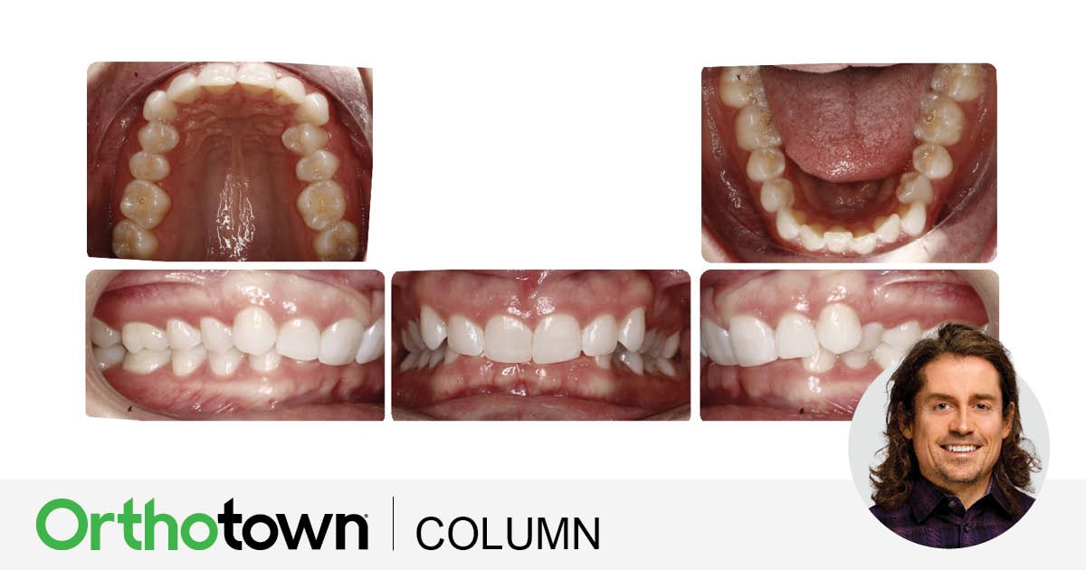 A Voice in the Arena: A Case for 'Outside-In" Editorial director Dr. Chad Foster shares a case in which examining the patient photos and images from “outside-in” led to interesting treatment options.