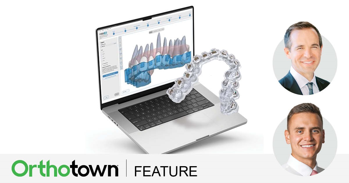 A Smile Transformed Drs. Dustin Burleson and Brandon Simister showcase how 3D printing significantly enhances
orthodontic treatment for a patient with cleft lip and palate, addressing treatment planning, bracket placement, indirect bonding trays and presurgical splint fabrication.