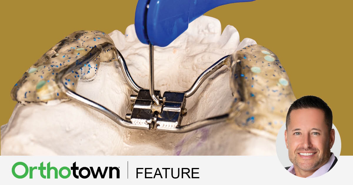 CE: Expand Your Reality Dr. Michael K. DeLuke discusses slow maxillary expansion options, which patients would benefit most from such treatment and more.