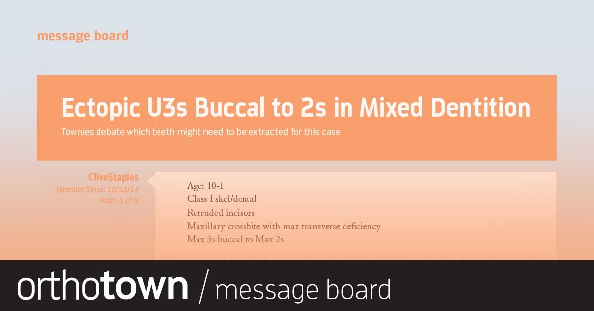 Ectopic U3s Buccal to 2s in Mixed Dentition Townies debate which teeth might need to be extracted for this case