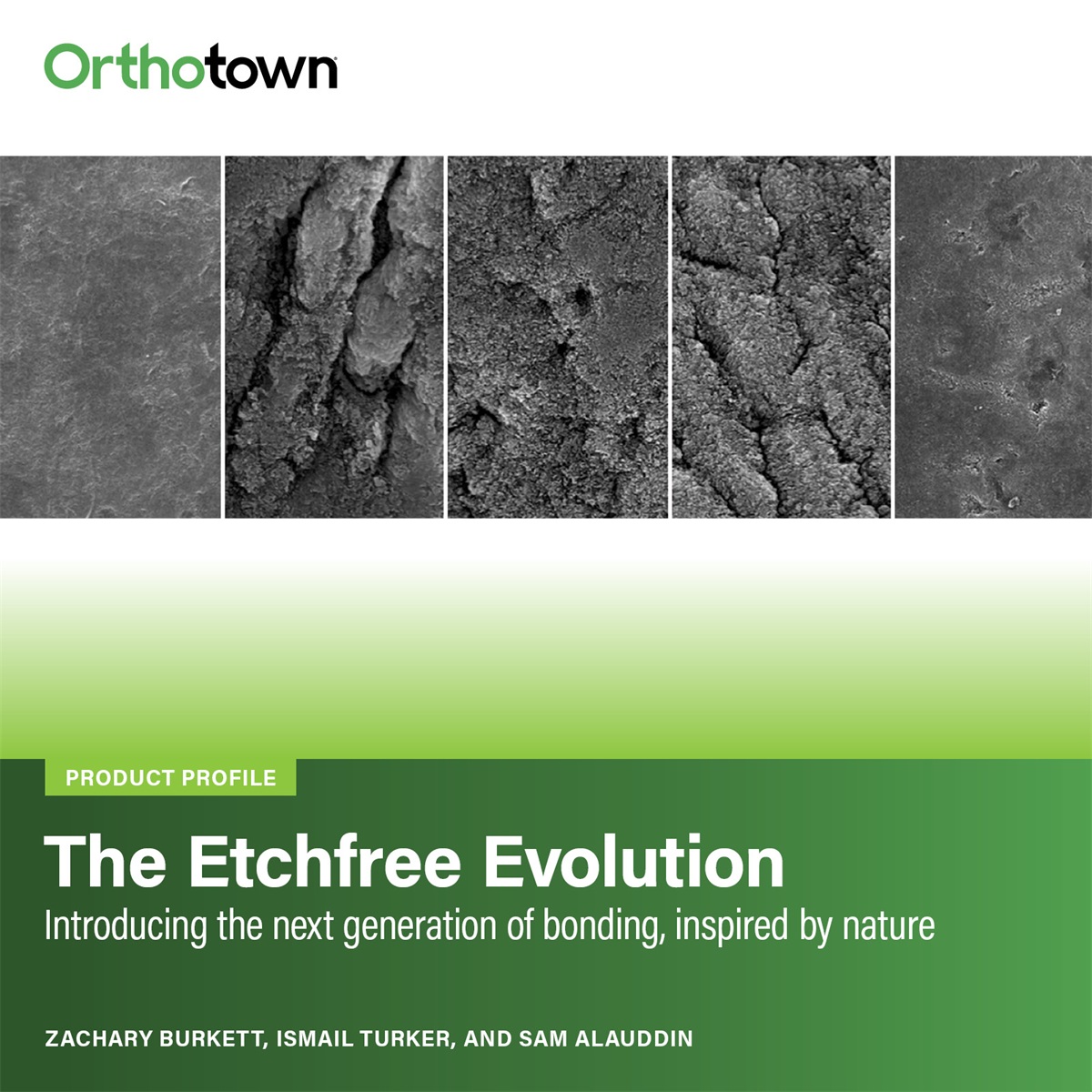 Industry Insights: The EtchFree Evolution An overview of Ormco’s biomimetic bonding system that replaces traditional etching with a moisture-tolerant, enamel-preserving approach inspired by marine mussels.