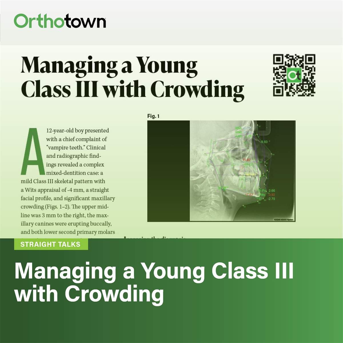 Managing a Young Class III with Crowding A 12-year-old patient with significant maxillary crowding and a mild Class III skeletal pattern prompted a discussion about managing complex mixed-dentition cases and setting the stage for long-term stability.