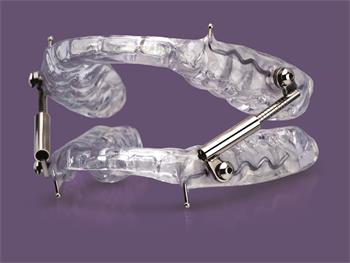 Glidewell Dental Introduces a New Oral Sleep Appliance