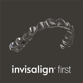 Align Technology Introduces Invisalign Clear Aligners for Phase 1 Treatment