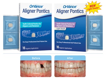 OrVance Expands Aligner Pontics With New Light Shade