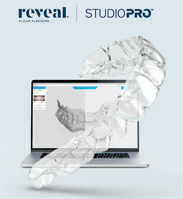 Henry Schein Orthodontics Launches Treatment Planning Software for Reveal Clear Aligners
