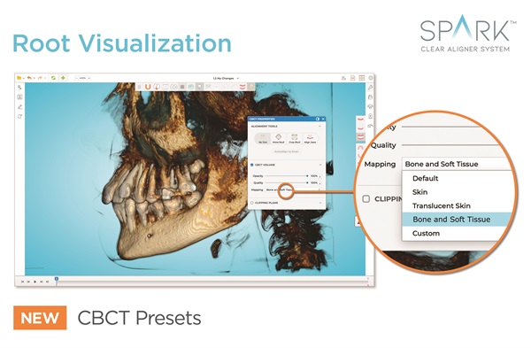 Spark Clear Aligners New Release Enhances Patient Root Visualization