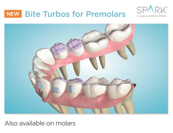Spark Clear Aligners New Release Enhances Patient Root Visualization