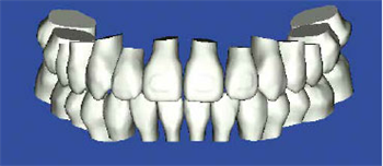 Planmeca Imaging Units Now Certified for Use with OraMetrix’s Suresmile