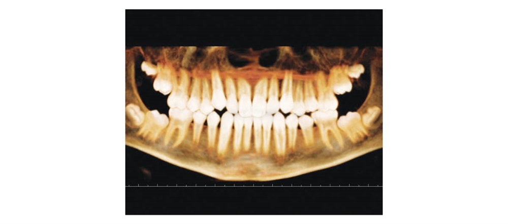 CE: Phase I Treatment
