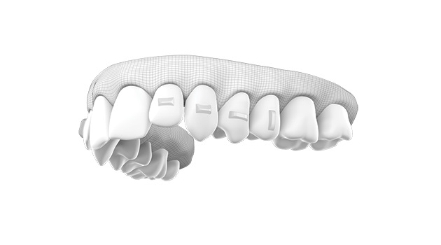 3M Clarity Precision Grip Attachments
