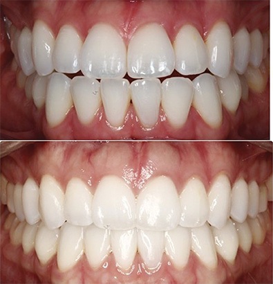 The Architects of the Lips: Part 2