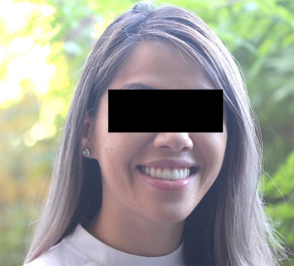 The Architects of the Lips: Part 2