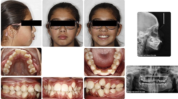 The Architects of the Lips: Part 2
