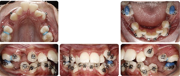 The Architects of the Lips: Part 2