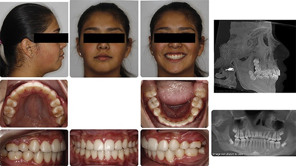 The Architects of the Lips: Part 2