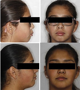 The Architects of the Lips: Part 2