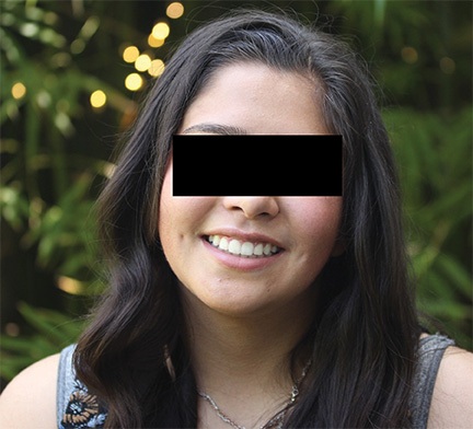 The Architects of the Lips: Part 2