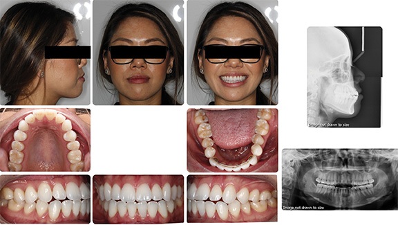 The Architects of the Lips: Part 2