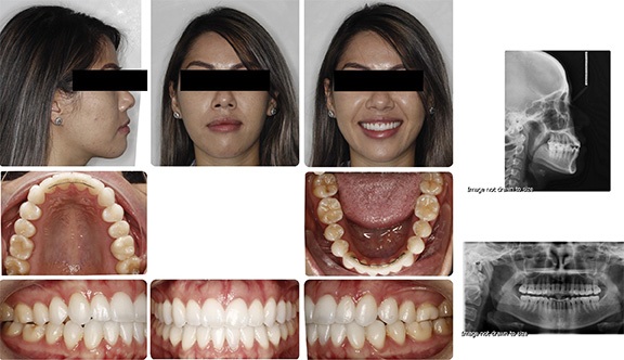 The Architects of the Lips: Part 2