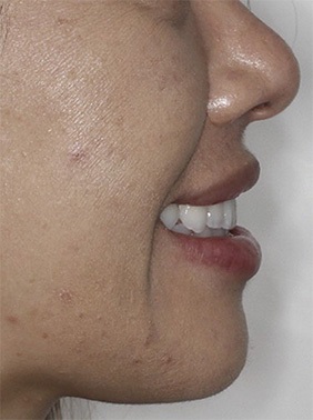 The Architects of the Lips: Part 2