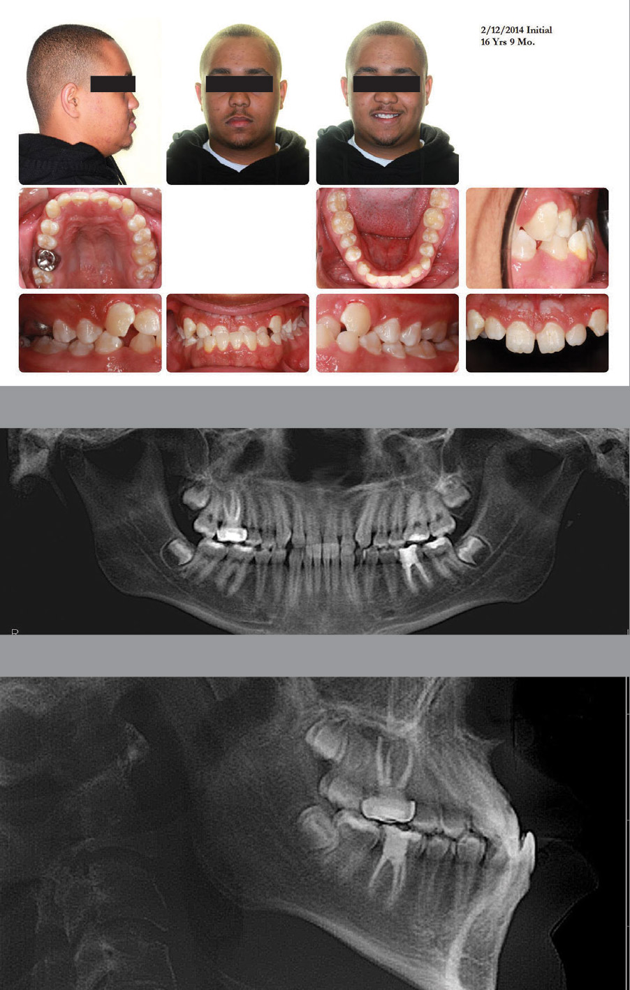 16 year old male patient