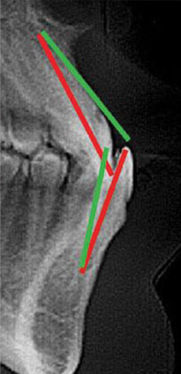 pre-treatment pics of male patient