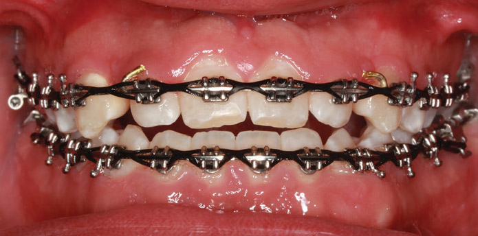pre-treatment pics of male patient cont.