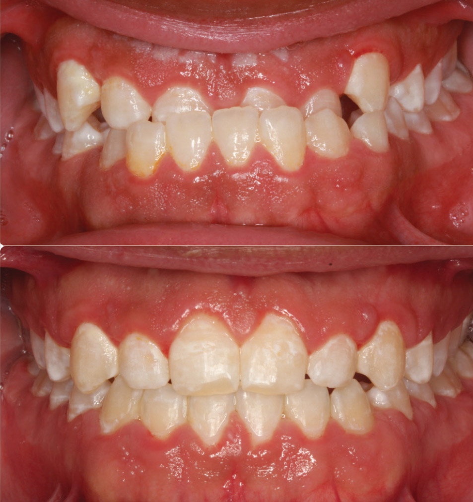 before and after pictures of male patient